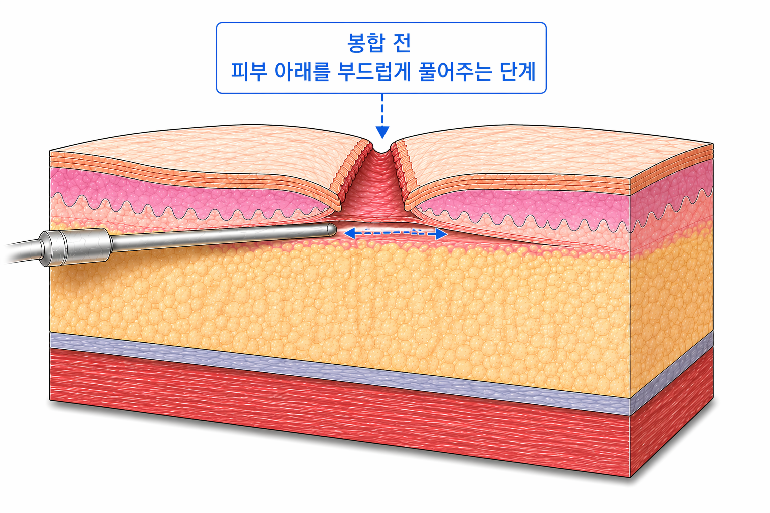 사진삽입 ③