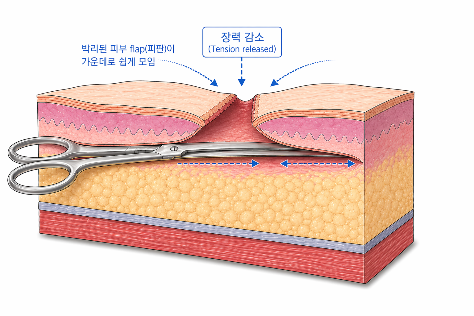 사진삽입 ④